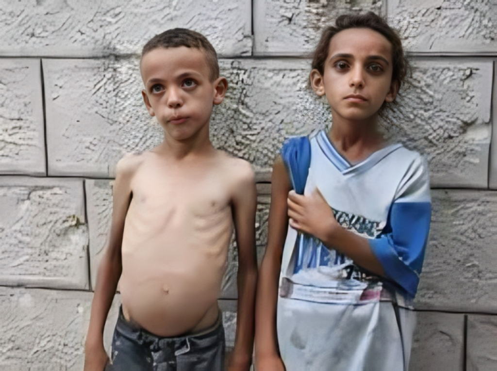 Famine Starvation The Challenges in Defining Gazas Plight 1753608955 'Famine', 'Starvation': The Challenges in Defining Gaza's Plight