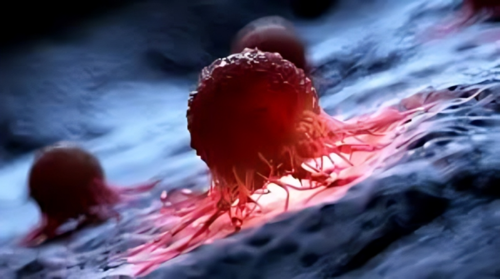 Liver Cancer Cases May Double by 2050 But Most Are Preventable Study 1753782380 Liver Cancer Cases May Double by 2050, But Most Are Preventable: Study