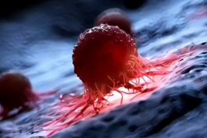 Liver Cancer Cases May Double by 2050, But Most Are Preventable: Study