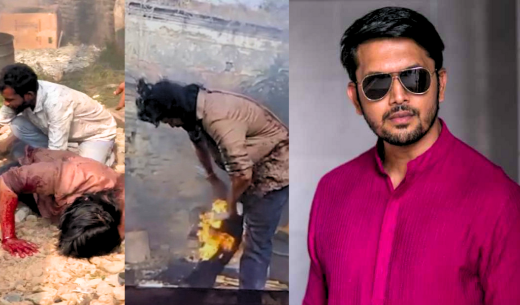 Actor Arifin Shuvoo Suffers Burns on Shooting Set 3 actor arifin shuvoo suffers burns on shooting set Actor Arifin Shuvoo Suffers Burns on Shooting Set