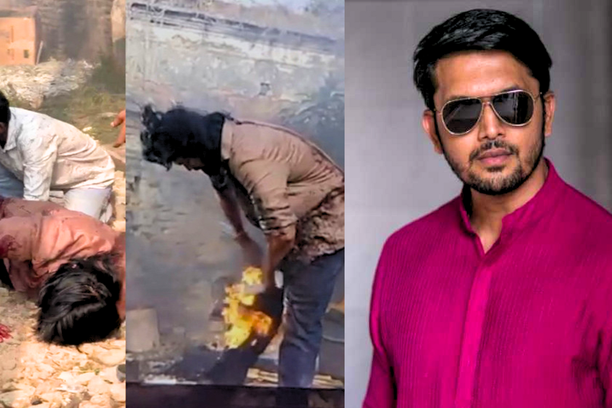 Actor Arifin Shuvoo Suffers Burns on Shooting Set