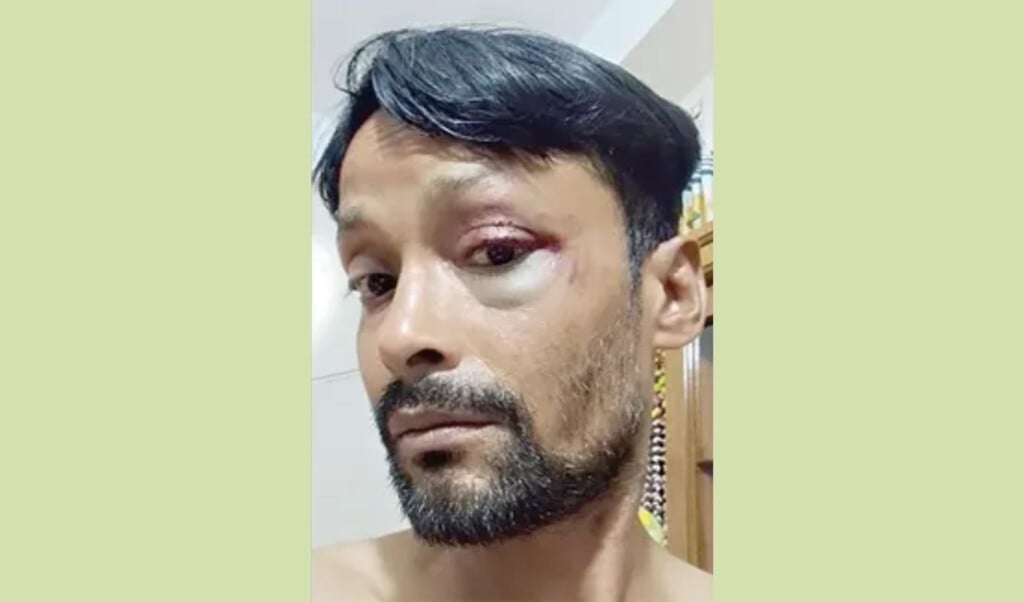 allegations of beating at july foundation under the pretext of interrogation Allegations of Beating at July Foundation Under the Pretext of ‘Interrogation’