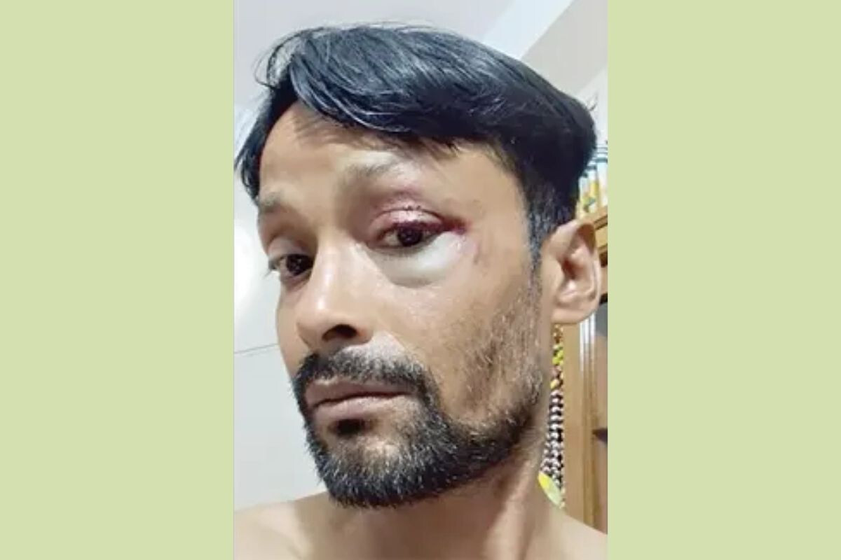 Allegations of Beating at July Foundation Under the Pretext of ‘Interrogation’