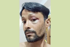 Allegations of Beating at July Foundation Under the Pretext of ‘Interrogation’