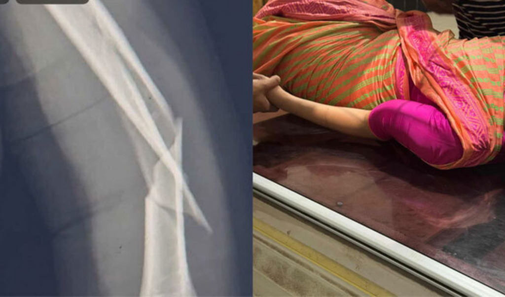 biman bangladesh flight hit by mid air turbulence cabin crew suffers broken arm Biman Bangladesh Flight Hit by Mid-Air Turbulence, Cabin Crew Suffers Broken Arm