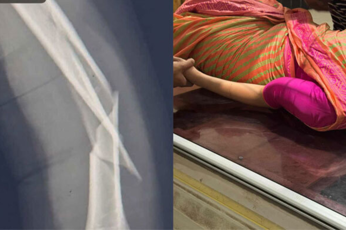 Biman Bangladesh Flight Hit by Mid-Air Turbulence, Cabin Crew Suffers Broken Arm