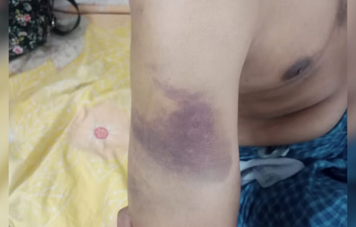 Brutal Abuse Allegations at Gaibandha Rehabilitation Centre