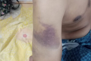 Brutal Abuse Allegations at Gaibandha Rehabilitation Centre
