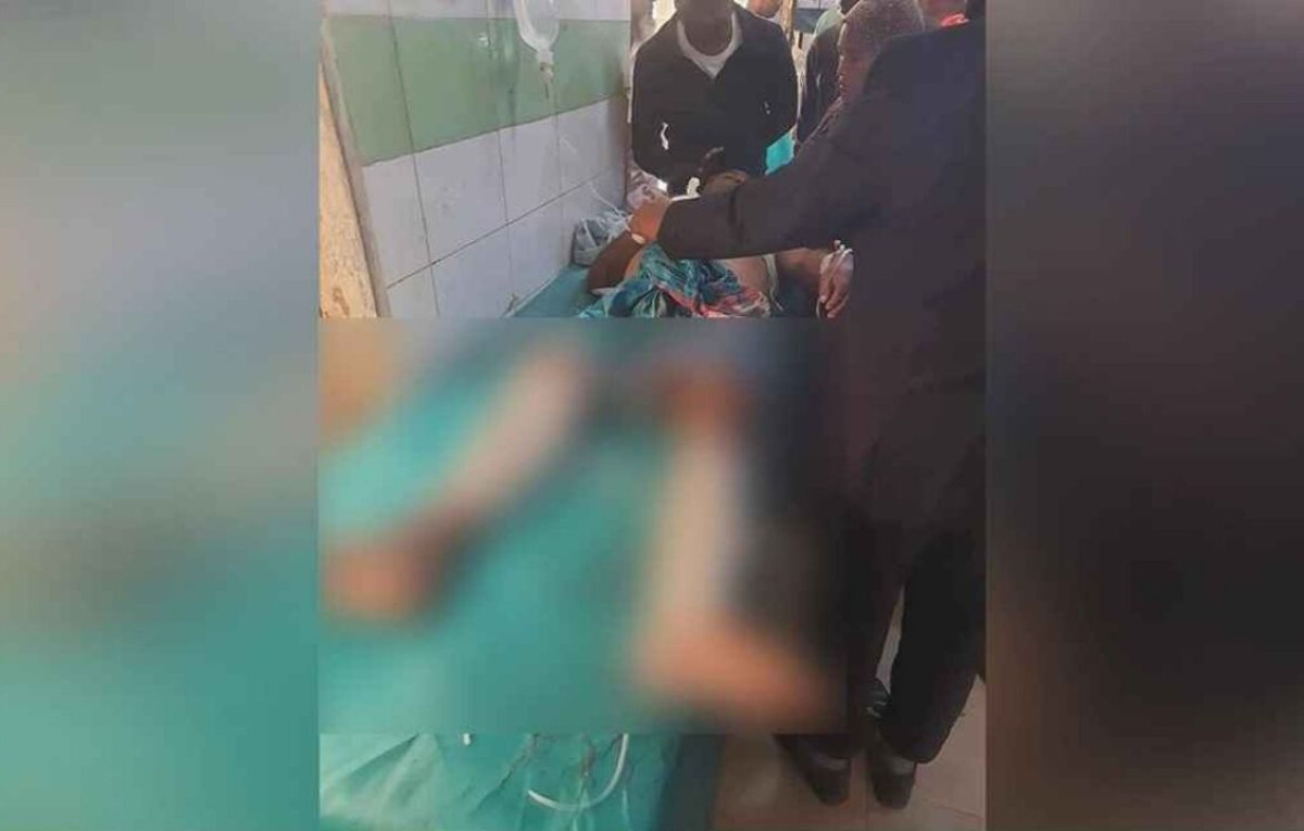 Brutal Maiming of Krishak Dal Leader in Rajshahi