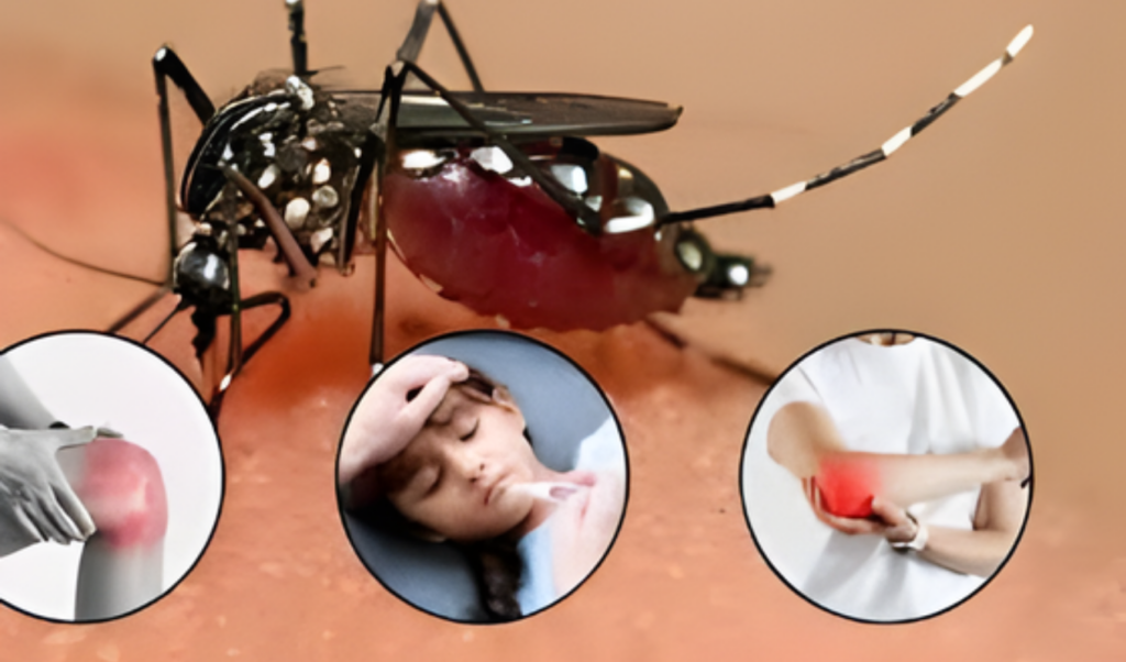chikungunya and dengue claim lives of 21 children in crisis stricken cuba Chikungunya and Dengue Claim Lives of 21 Children in Crisis-Stricken Cuba