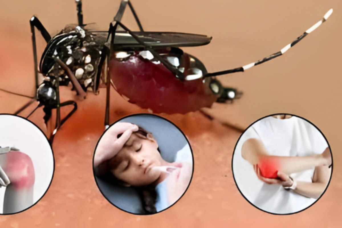 Chikungunya and Dengue Claim Lives of 21 Children in Crisis-Stricken Cuba