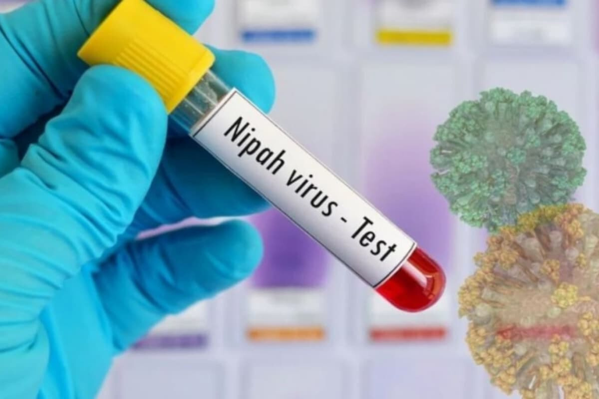 First Nipa Virus Death Reported in Bangladesh