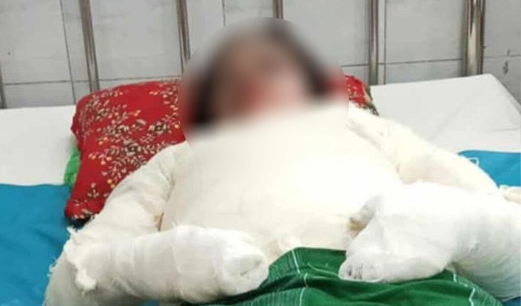 Housewife Burned to Death, Husband and In-laws on the Run 2 housewife burned to death husband and in laws on the run Housewife Burned to Death, Husband and In-laws on the Run