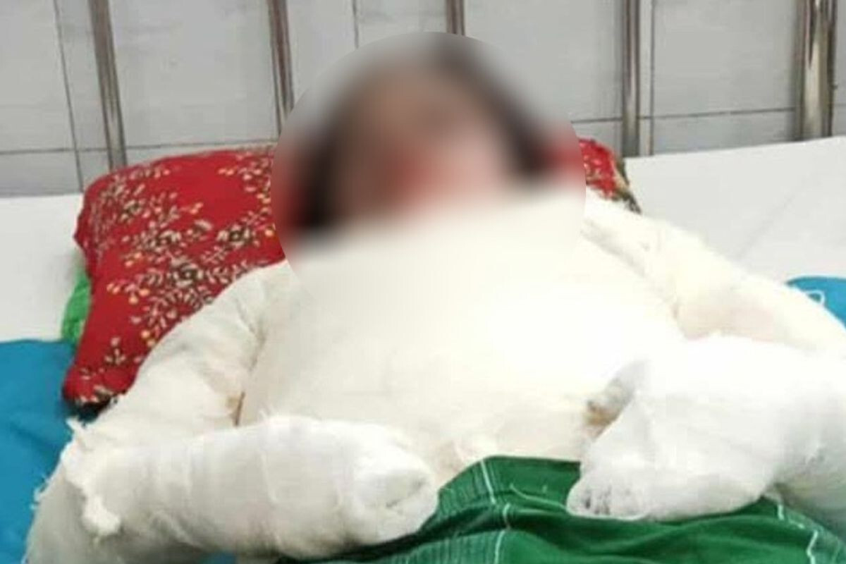 Housewife Burned to Death, Husband and In-laws on the Run