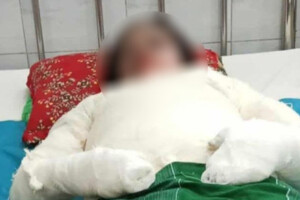 Housewife Burned to Death, Husband and In-laws on the Run