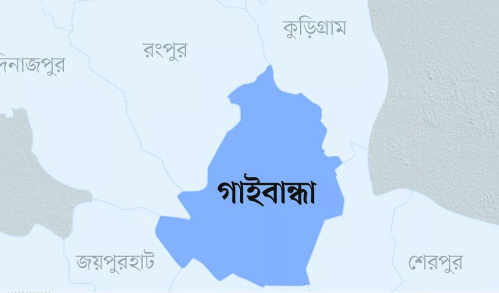 husband burns wifes face with hot rod and cuts her ankle in gaibandha Husband Burns Wife’s Face with Hot Rod and Cuts Her Ankle in Gaibandha