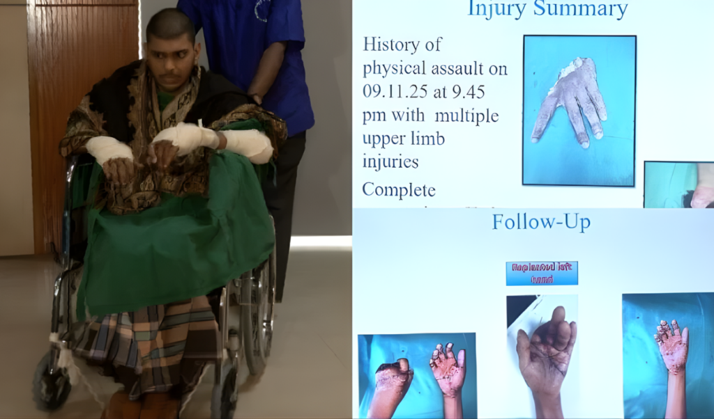 institute makes history reattaching severed hands after 20 hours Institute Makes History Reattaching Severed Hands After 20 Hours