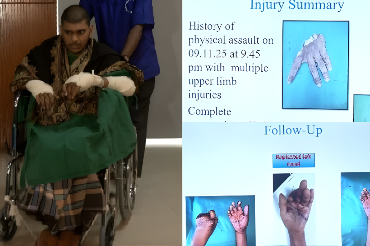 Institute Makes History Reattaching Severed Hands After 20 Hours