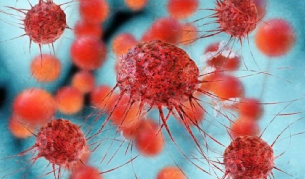 large proportion of cancers can be prevented Large Proportion of Cancers Can Be Prevented