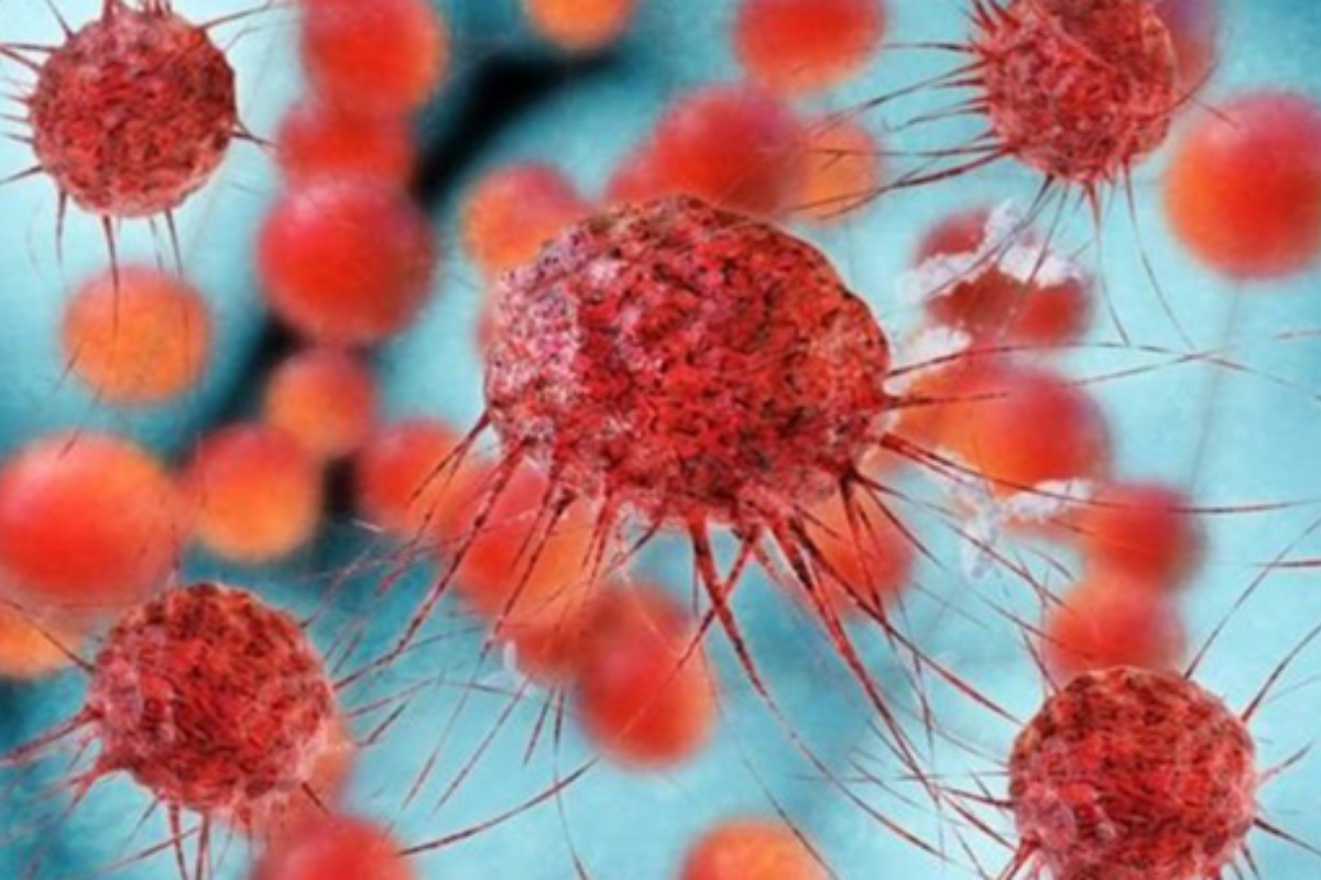 Large Proportion of Cancers Can Be Prevented