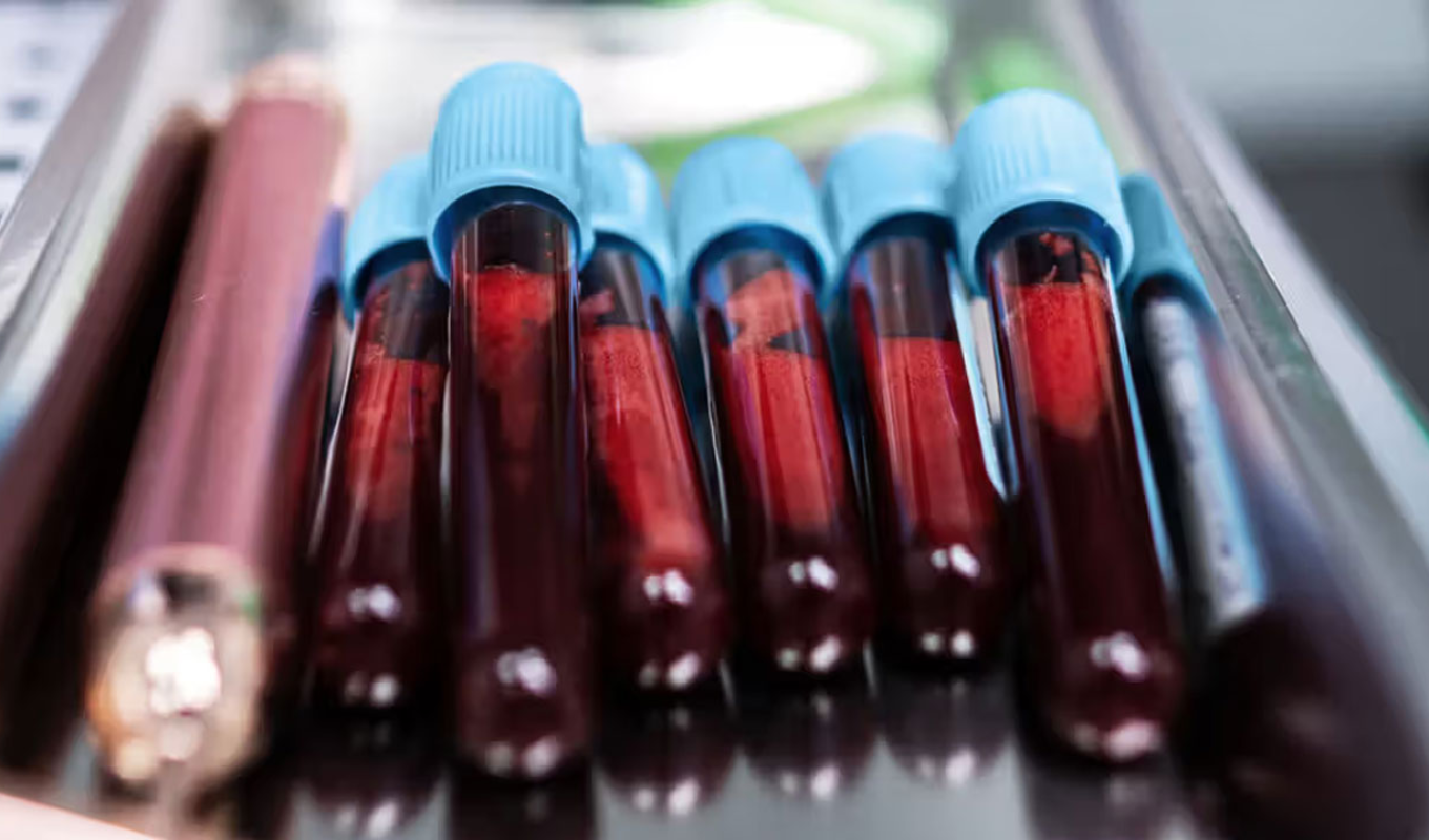 liquid biopsy offers hope in advanced breast cancer Liquid Biopsy Offers Hope in Advanced Breast Cancer