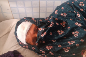 Teacher and daughter injured in Bauphal robbery attempt