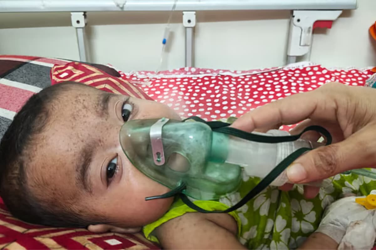 Three Children Die Amid Measles Symptoms in Six Hours