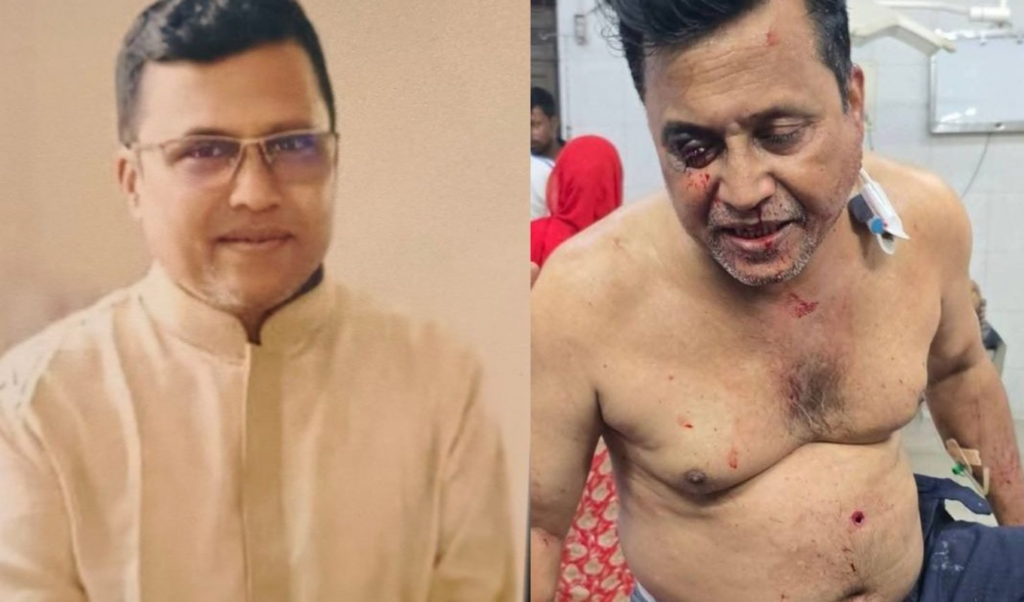 awami league leader shot in kushtia attack Awami League Leader Shot in Kushtia Attack