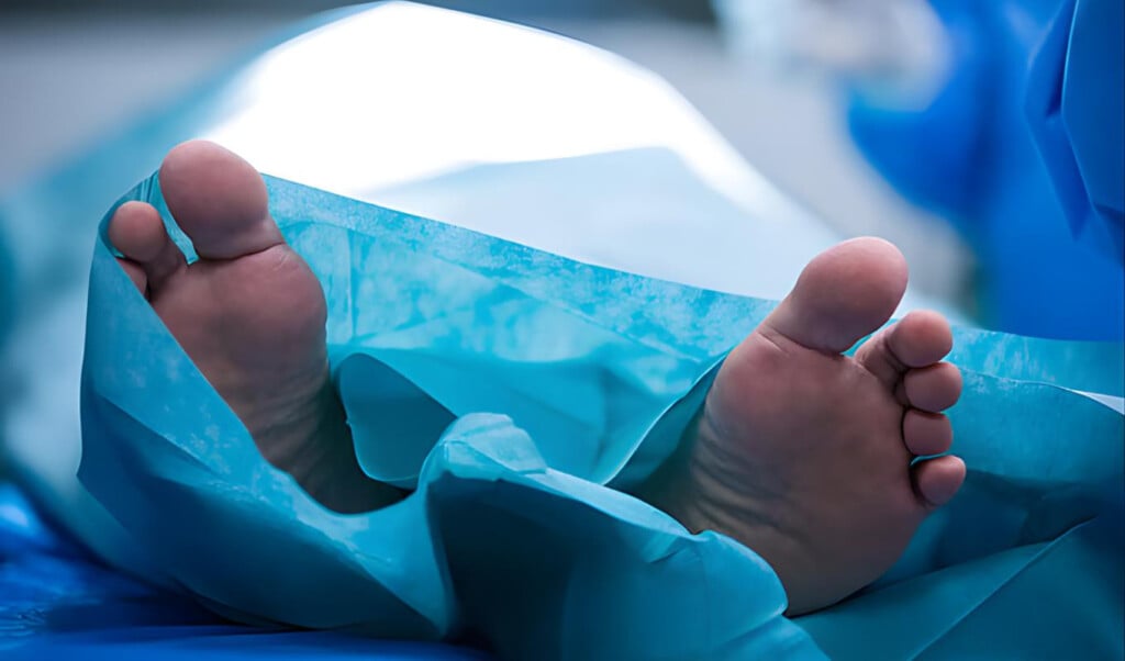 infant dies after measles symptoms Infant Dies After Measles Symptoms