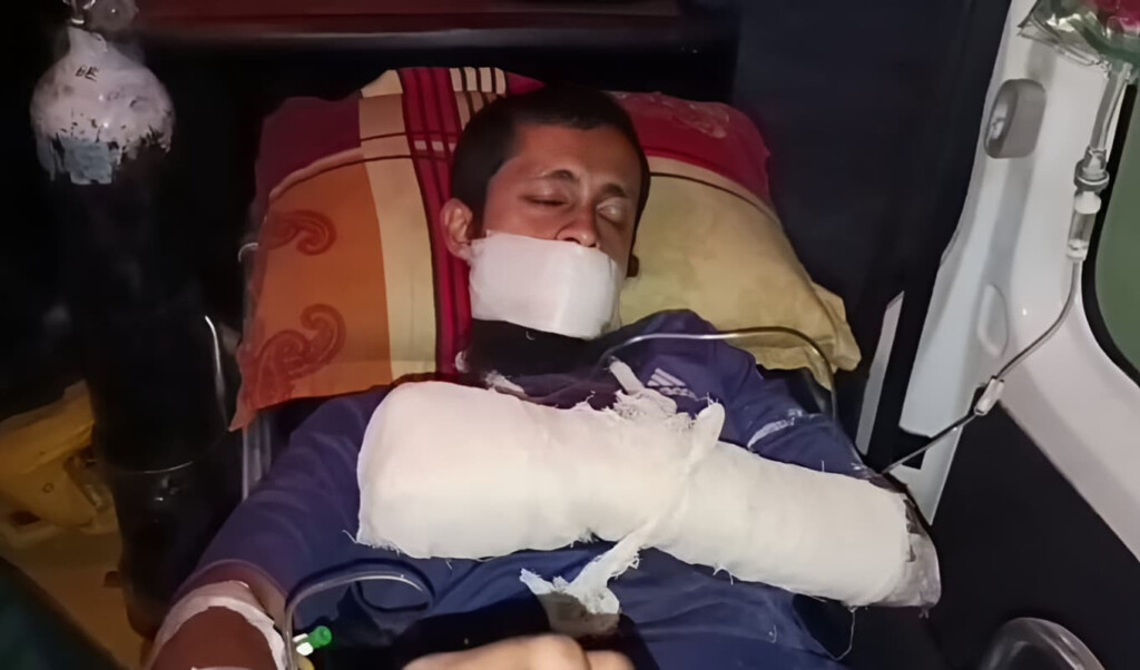 madrasa student severely injured in home explosion while making cocktail 1 Madrasa Student Severely Injured in Home Explosion While Making Cocktail