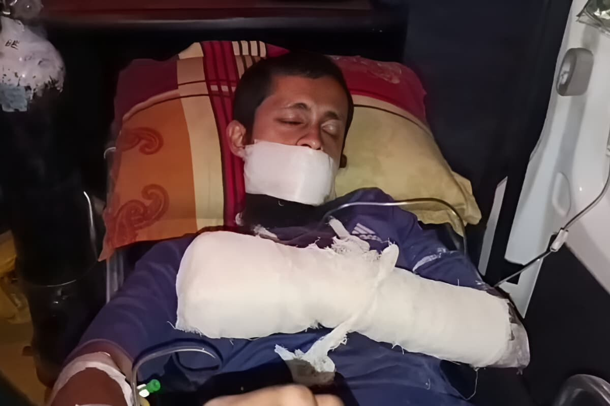 Madrasa Student Severely Injured in Home Explosion While Making Cocktail