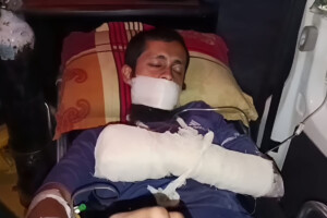 Madrasa Student Severely Injured in Home Explosion While Making Cocktail