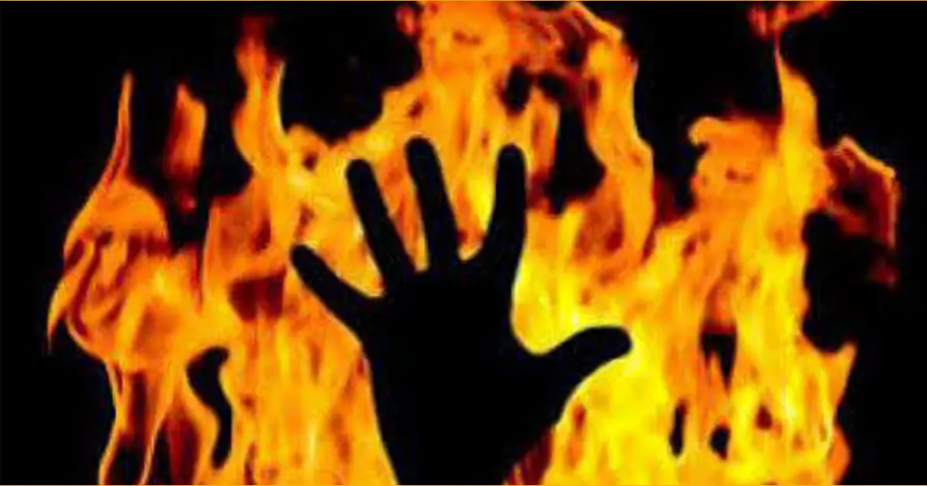 Transgender Individual Succumbs To Severe Petrol Burn Injuries Transgender Individual Succumbs To Severe Petrol Burn Injuries