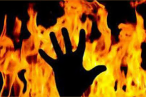 Transgender Individual Succumbs To Severe Petrol Burn Injuries
