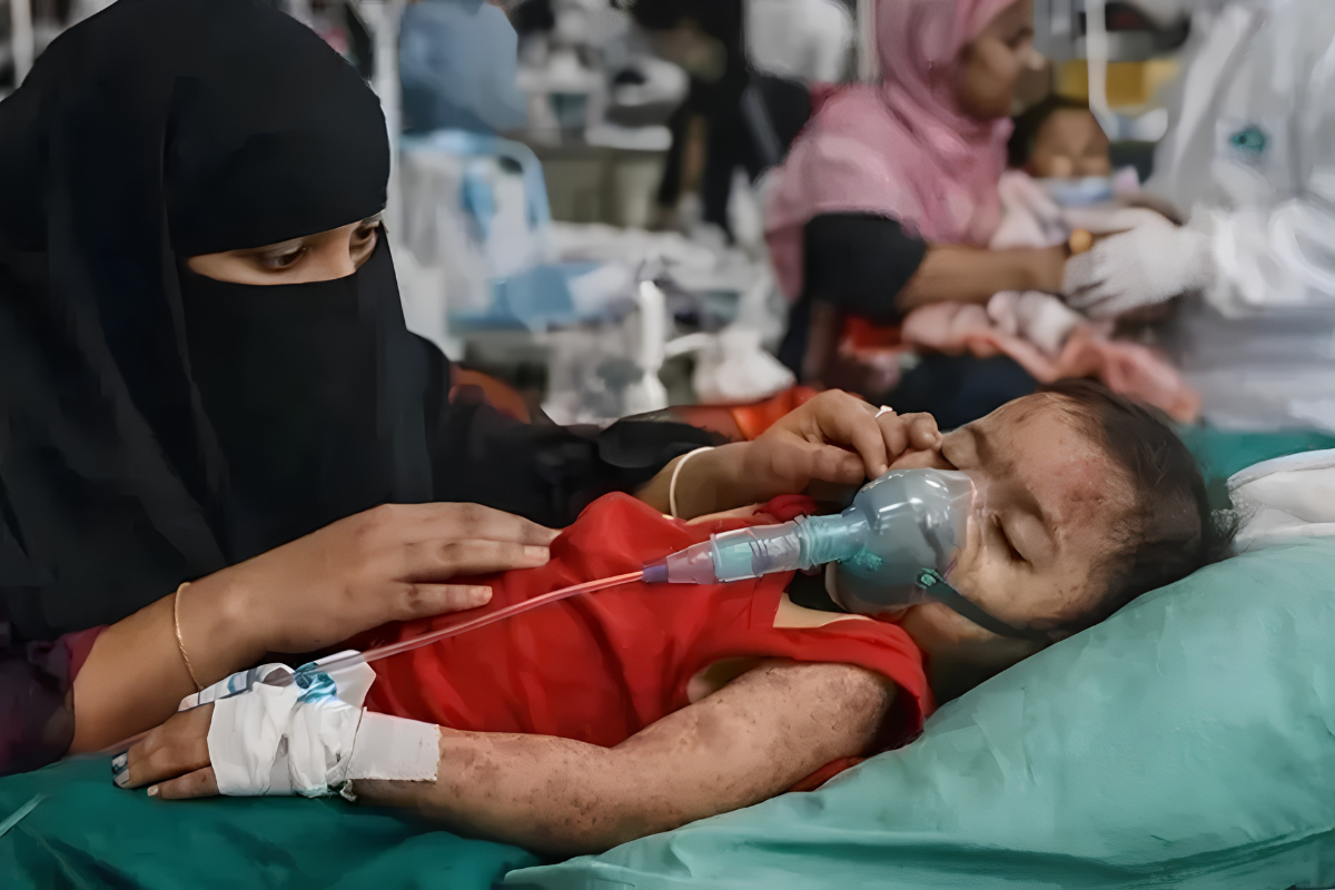 Five Children Die of Measles in Sylhet