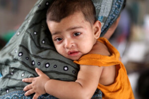 Child Deaths Rise Amid Measles Symptoms Nationwide