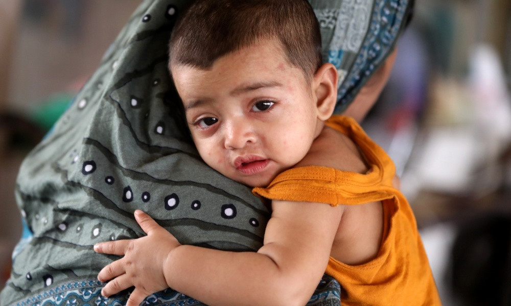 Child Deaths Rise Amid Measles Symptoms Nationwide