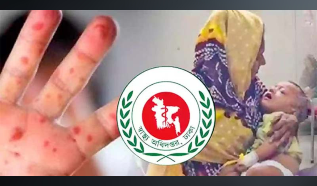 Measles Outbreak Claims 643 Lives Over 89 day Period Measles Outbreak Claims 643 Lives Over 89-day Period