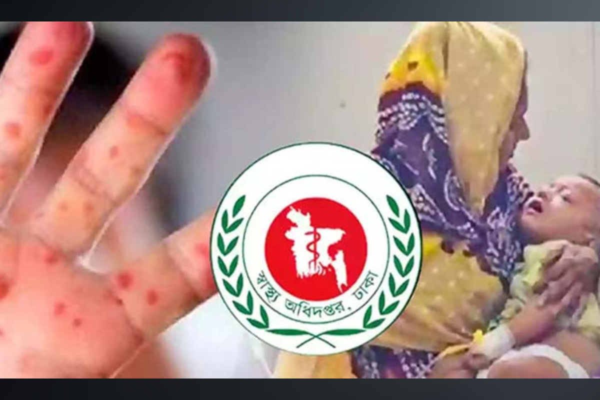 Measles Outbreak Claims 643 Lives Over 89-day Period