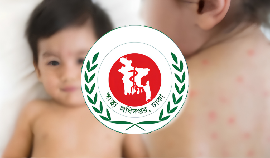 Nine More Children Die of Measles and Related Symptoms Nationally Nine More Children Die of Measles and Related Symptoms Nationally