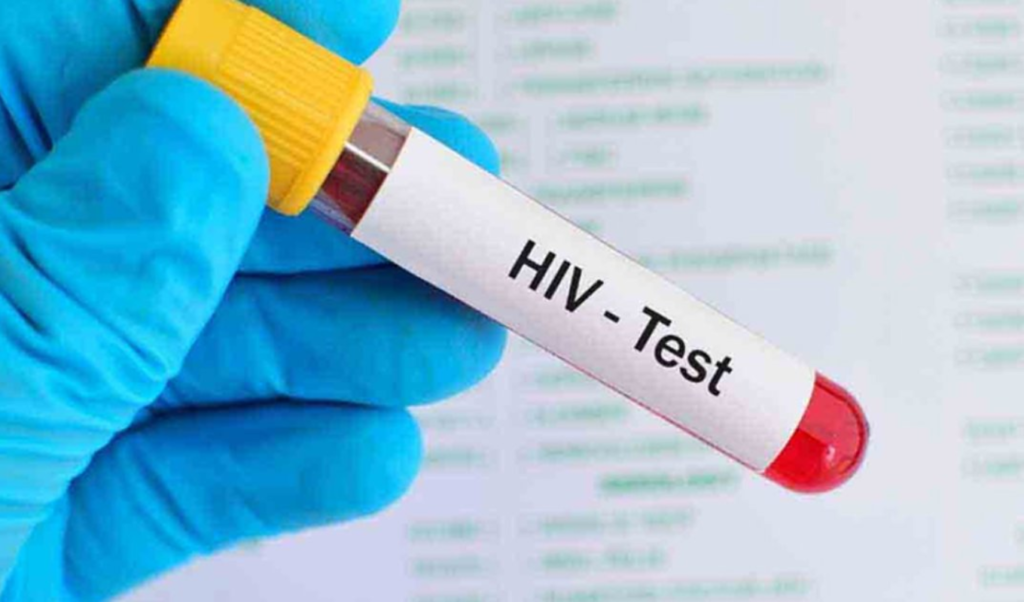 Sixteen HIV Cases Confirmed in Pabna District Bangladesh Sixteen HIV Cases Confirmed in Pabna District Bangladesh