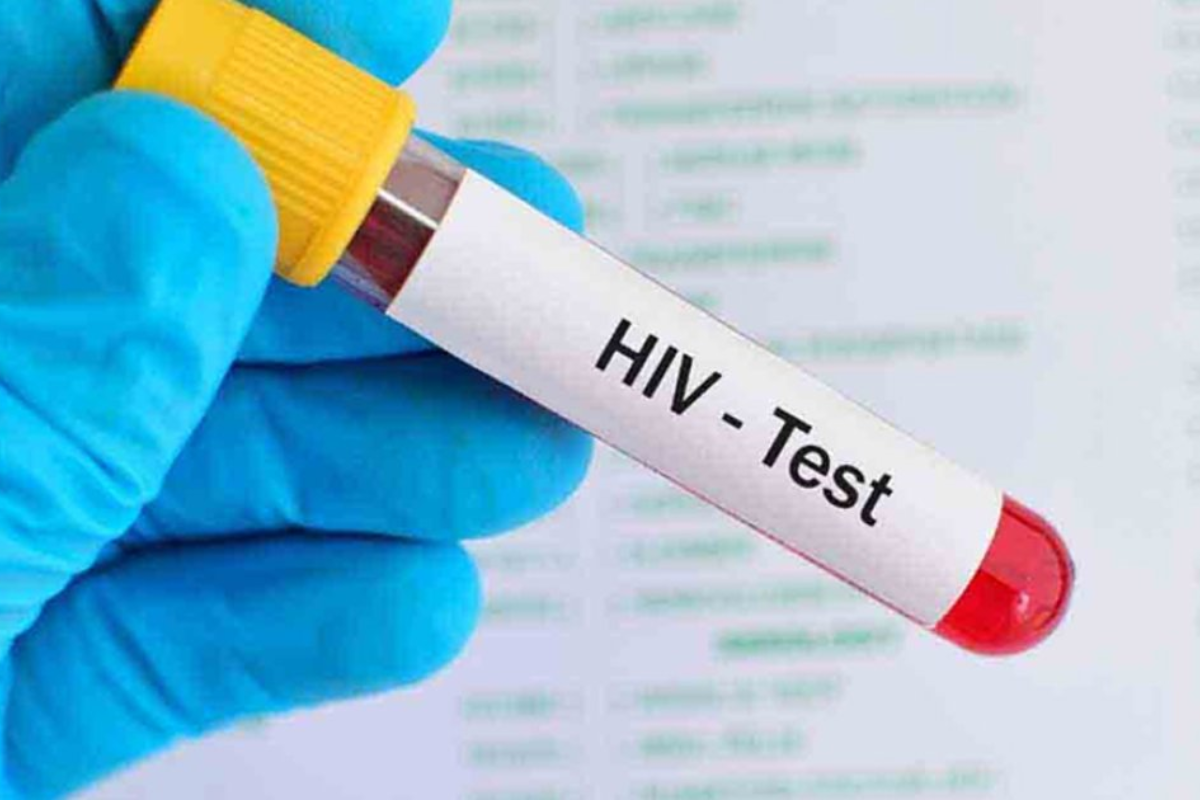 Sixteen HIV Cases Confirmed in Pabna District Bangladesh