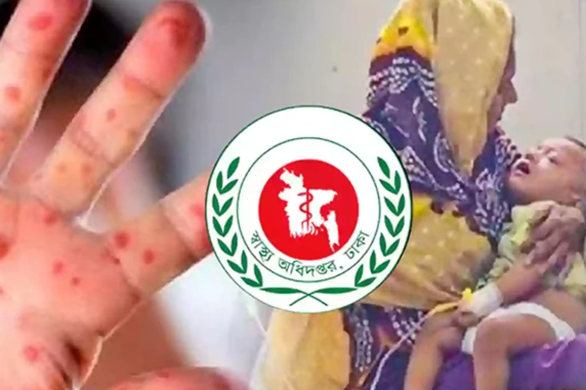 Five die of measles-like symptoms as cases pass 96,000
