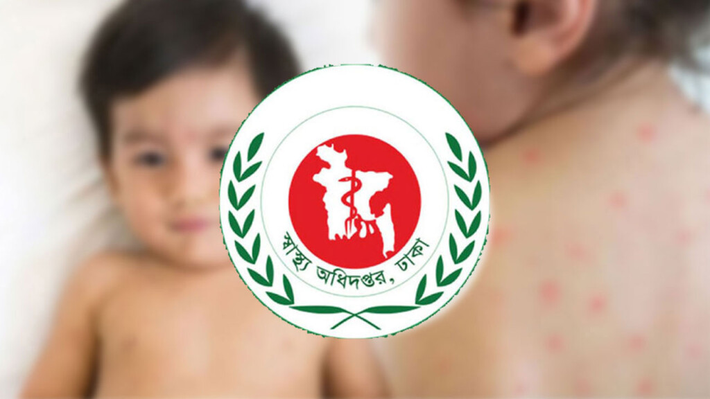 Measles Death Toll Nears 800 Measles Death Toll Nears 800