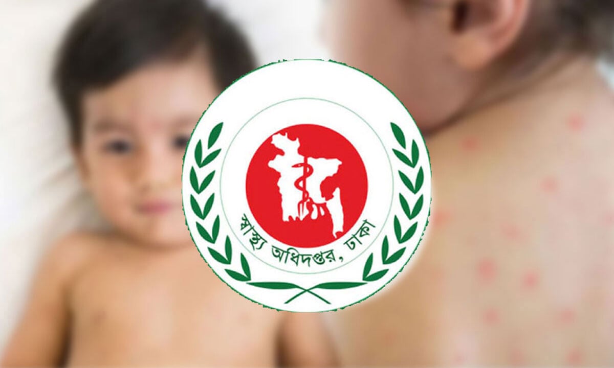 Measles Death Toll Nears 800