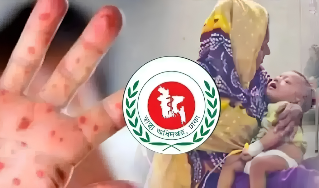 Seven Dead in One Day as Bangladesh Measles Cases Surge Seven Dead in One Day as Bangladesh Measles Cases Surge