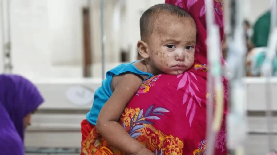 Three More Suspected Measles Deaths Reported Across Bangladesh