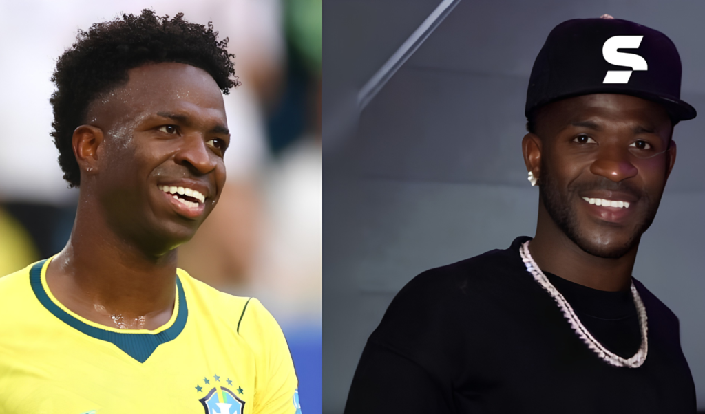 Vinicius Junior Undergoes Cosmetic Procedure to Alter Facial Features Vinícius Júnior Undergoes Cosmetic Procedure to Alter Facial Features
