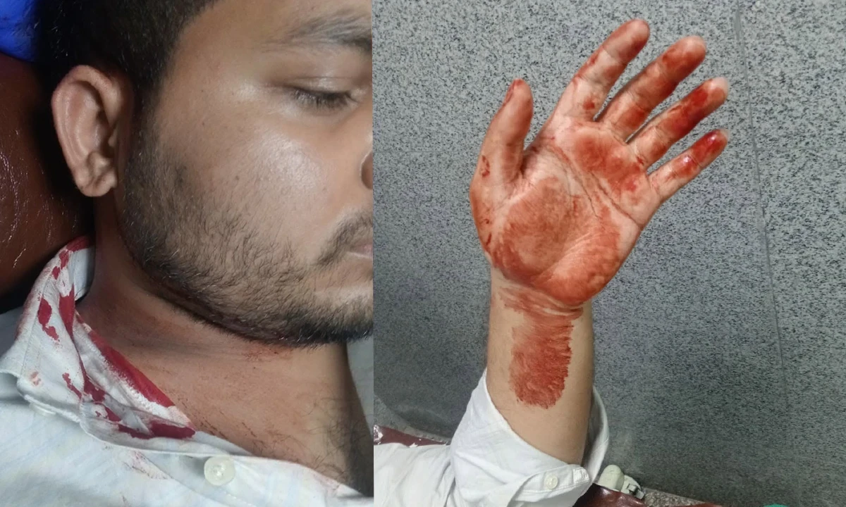 Dhaka College Tensions Rise After Student Groups Clash