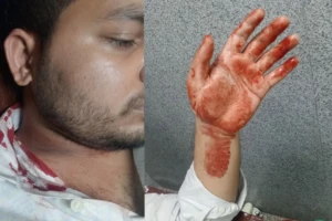 Dhaka College Tensions Rise After Student Groups Clash